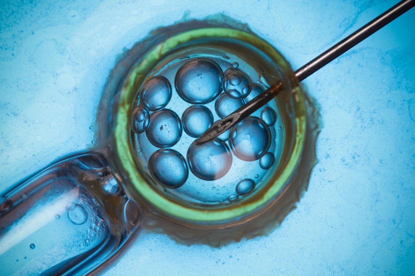 Fertility Revolution: How Technology is Changing Reproduction