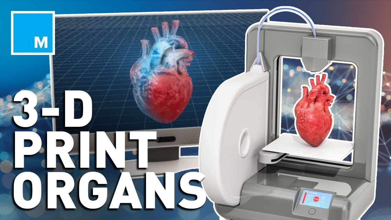 How has 3D printing been able to save War Veterans?