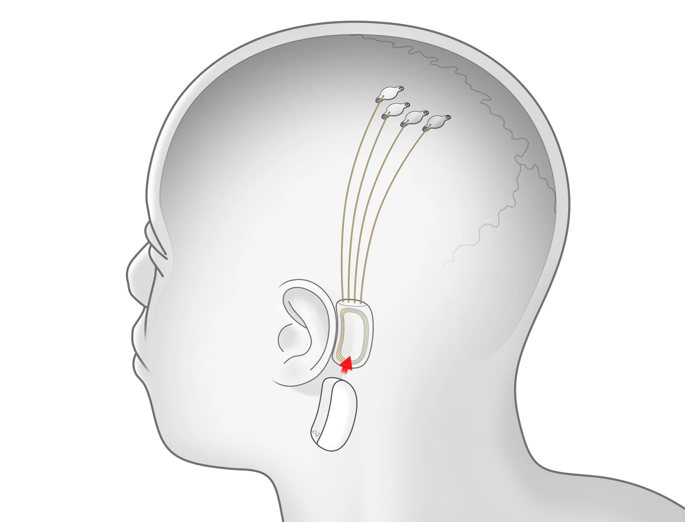 Elon Musk’s Company Neuralink has received FDA approval